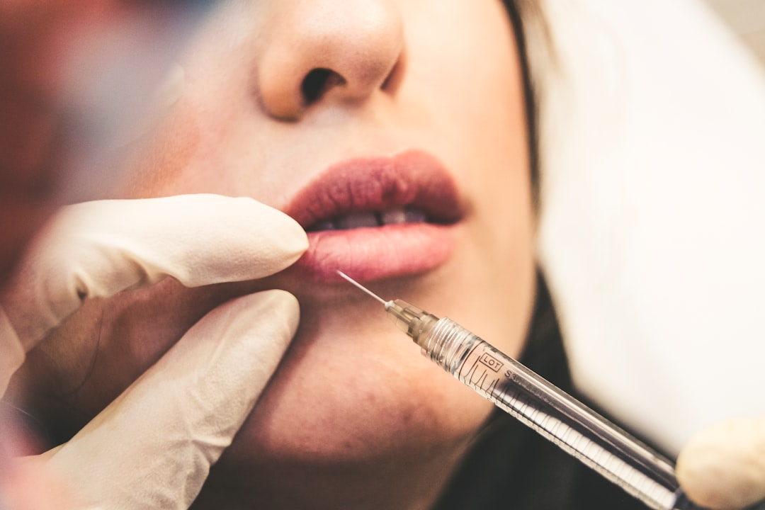 Preenchimento Labial na Melloclinic